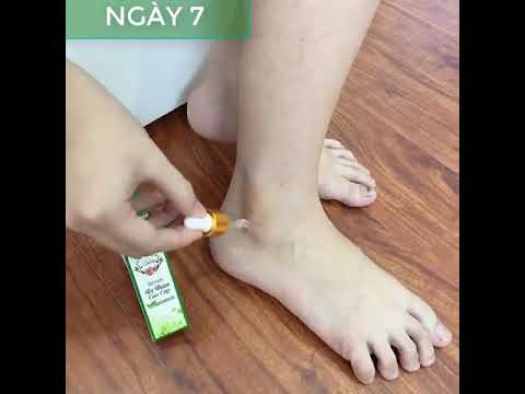 Serum trị thâm Singo cao cấp