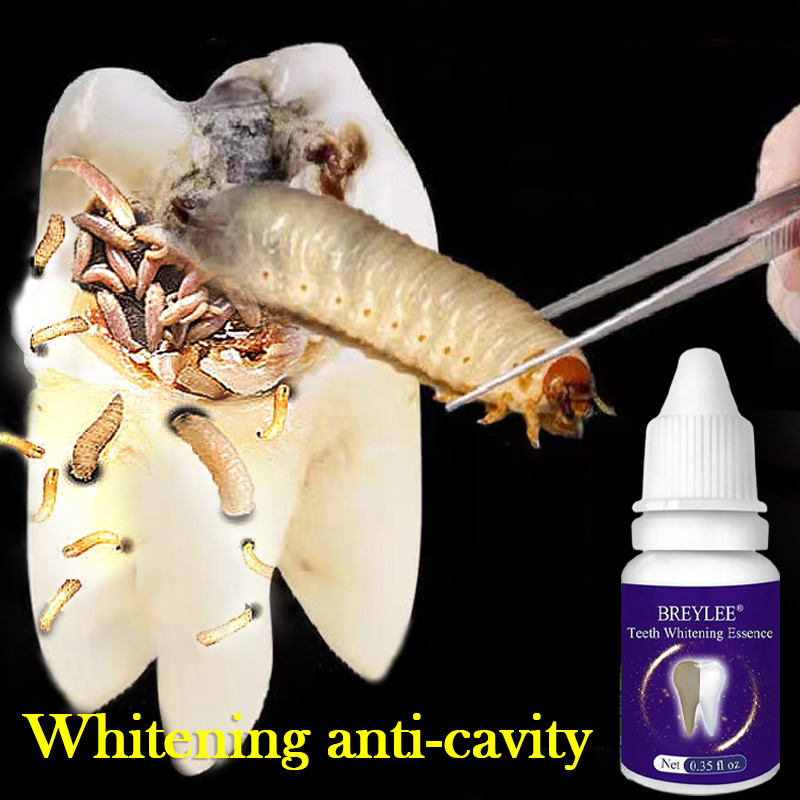 Gambar pemutih gigi kuning teeth whitening toothpaste hot sale ubat gigi pemutih Teeth Whitening Essence Remove Tartar Calculus Wash Yellow White Lotion Oral Hygiene Cleaning Serum Flawless Tooth Teeth Oral Hygiene Essence Whitening Essence Daily Use Effective