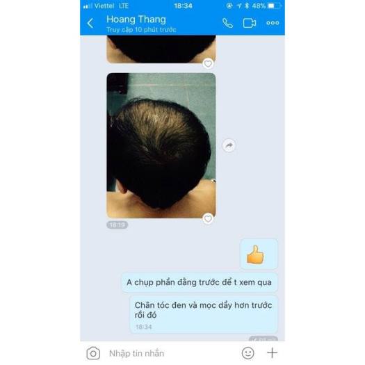 Tinh Dầu Haco: Xịt Tóc Mao Bạt Khang