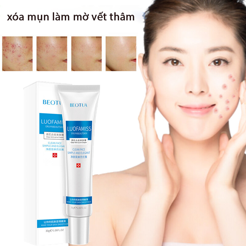 Tinh chất gel xóa mụn Kem xóa vết thâm mụn 30g làm mờ vết thâm mụn, loại bỏ mụn trứng cá, mụn bọc