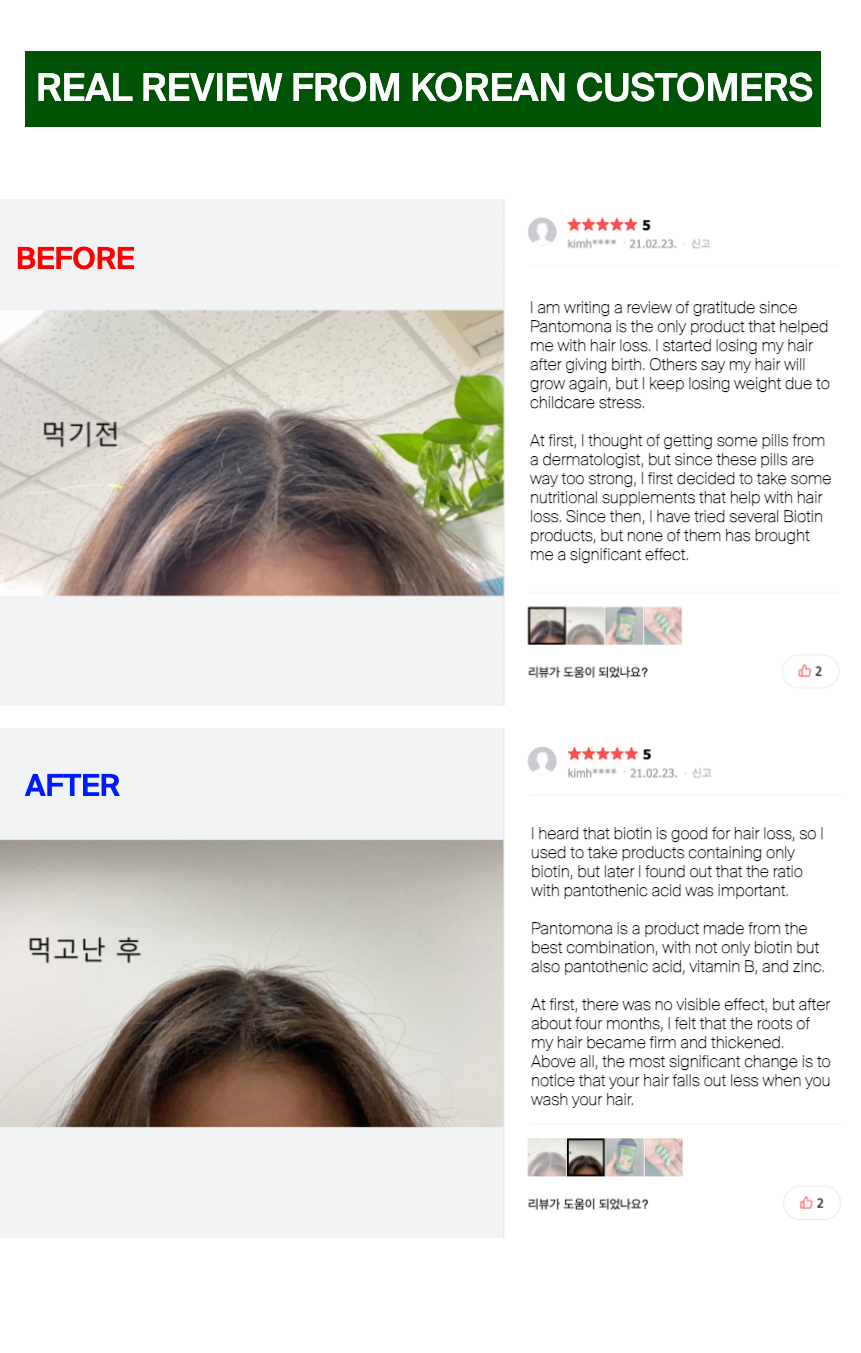 Korean  Premium Pantomona Biotin supplement, L-cysteine ,folate, Zinc,  Pantothenic acid, Vitamin B, Brewers yeast supplement, postpartum hair loss(hair  fall) / hair growth, nail health for 2 months [240ea] (inner beauty Seoul) |