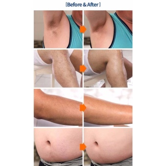 Dr. Hair Body Removal KING Cream For Men Women 100g - Intl June 2018 - 3 Dr. hair body removal KING cream for men women 100g - intl - 3