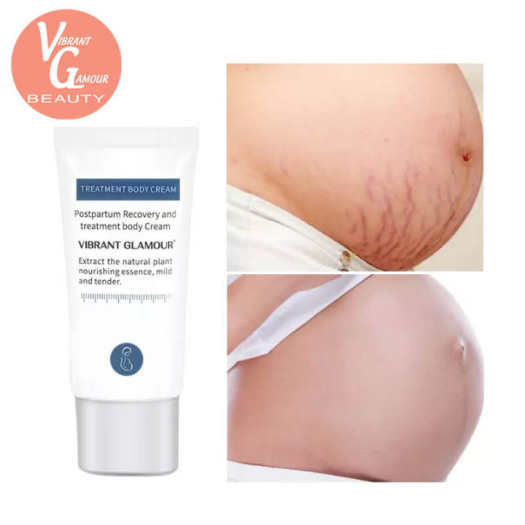 VIBRANT GLAMOUR Kem Trị Rạn Da Xóa Sẹo Cho Da Mịn Màng Phục Hồi Da Sau Sinh Loại Bỏ Vết Nứt Do Tăng Cân