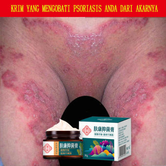 Kem bôi vẩy nến, viêm da kháng khuẩn đánh bay nấm da Kem giảm ngứa 30G Kem bôi ngứa Thích hợp dùng cho bôi chàm ngứa, ghẻ, vẩy nến Tinh chất thảo dược chăm sóc da giảm ngứa