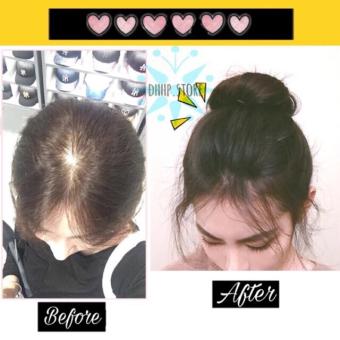 Tóc giả che hói ❤️FREESHIP❤️ Tóc giả kẹp phồng che hói mái tóc