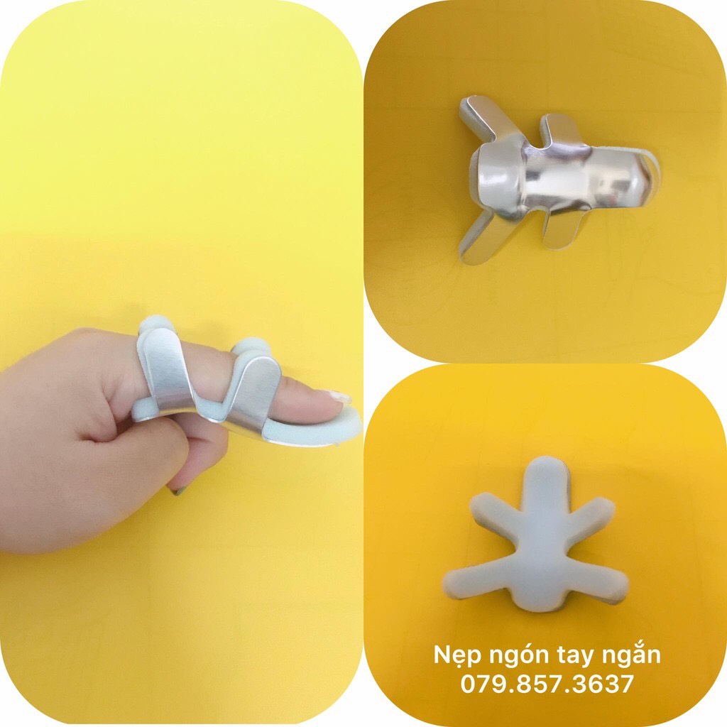 Nẹp nhôm ngón tay ngắn