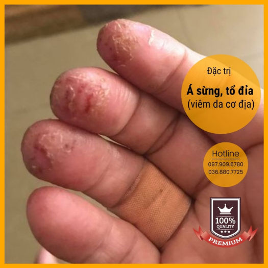 Dung dịch Anolyte KT (Nước A - Combo 3 chai 1,5lit)