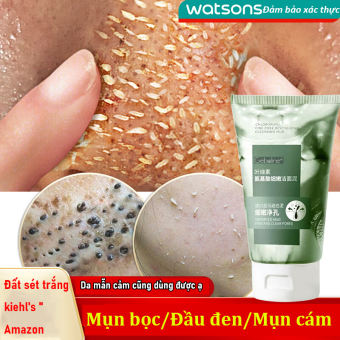 sữa rữa mặt sữa rửa mặt trị mụn cho da dầu sữa rửa mặt làm trắng da sửa rửa mặt trắng da trị mụn sữa rửa mặt làm trắng da