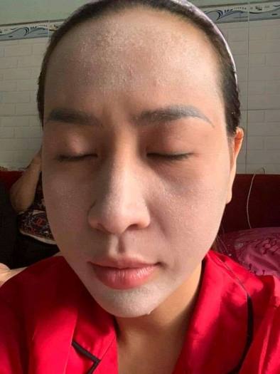 KEM FACE ĐÔNG Y TÁI TẠO VIP NHANH BONG & TẶNG kèm nước cốt sâm tái tạo da bong trong 7-14 ngày hủ 25G