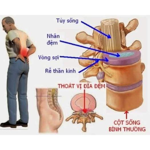 Dầu xoa bóp Đại Lực Hoàng 150ml và 120ml- dầu chùa linh phong- tự xoa tại nhà - Kiến Lửa