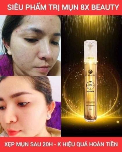 Serum Mụn 20h 8x Beauty Eccence
