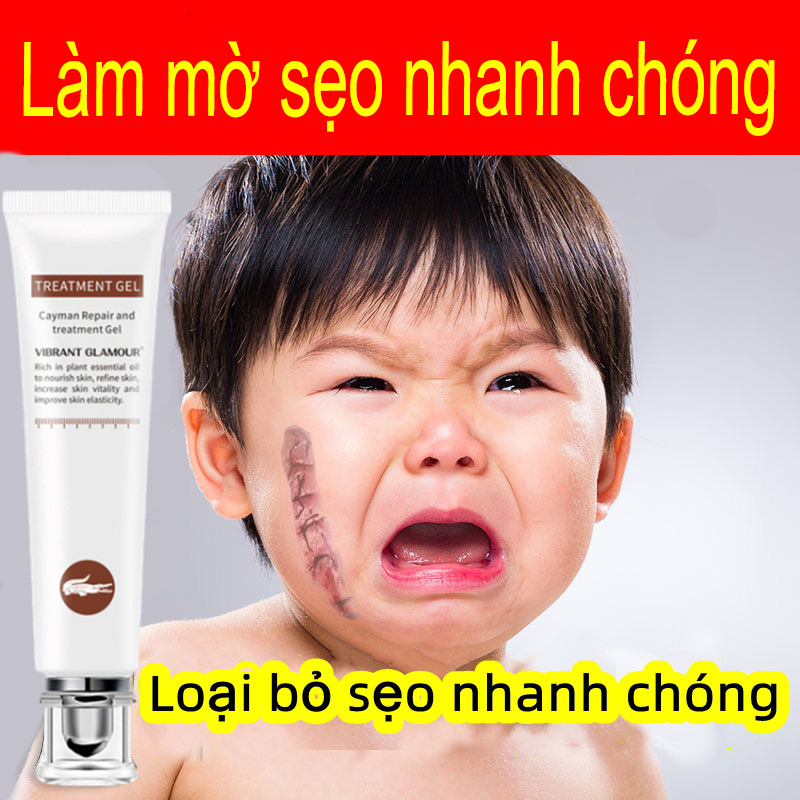 【Kem Xóa Sẹo】 Che khuyết điểm sẹo, xóa sẹo lồi mãn tính, sẹo bỏng, tinh chất chiết xuất từ ​​thiên nhiên, làm sáng sẹo, phục hồi da, hiệu quả nhanh chóng