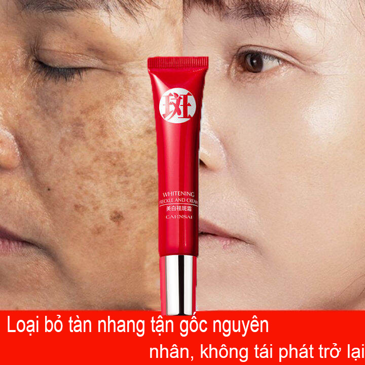 Kem trị nám trắng da xóa tàn nhang loại bỏ các đốm đen melanin loại bỏ chloasma làm sáng da chống lão hóa làm trắng da nhanh chóng