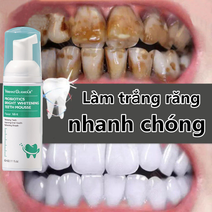 Mousse làm trắng răng 60ml thay cho kem đánh răng có tác dụng làm sạch răng, tẩy ố, ngừa sâu răng, hết hôi miệng, cho hơi thở thơm tho