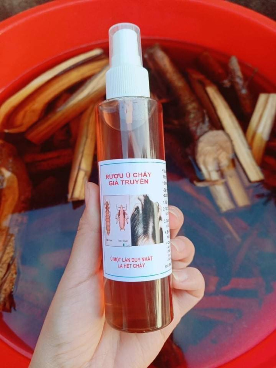 Ủ chấy chí thiên nhiên- an toàn cho cả trẻ nhỏ