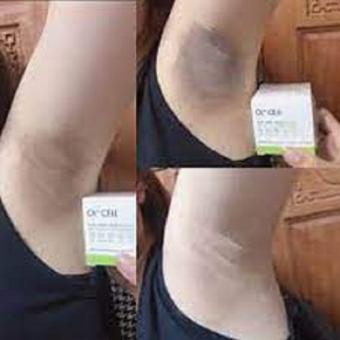 [ CHÍNH HÃNG ] Kem Trị Thâm Nách Thâm Môi Thâm Đầu Gối OL-CELL