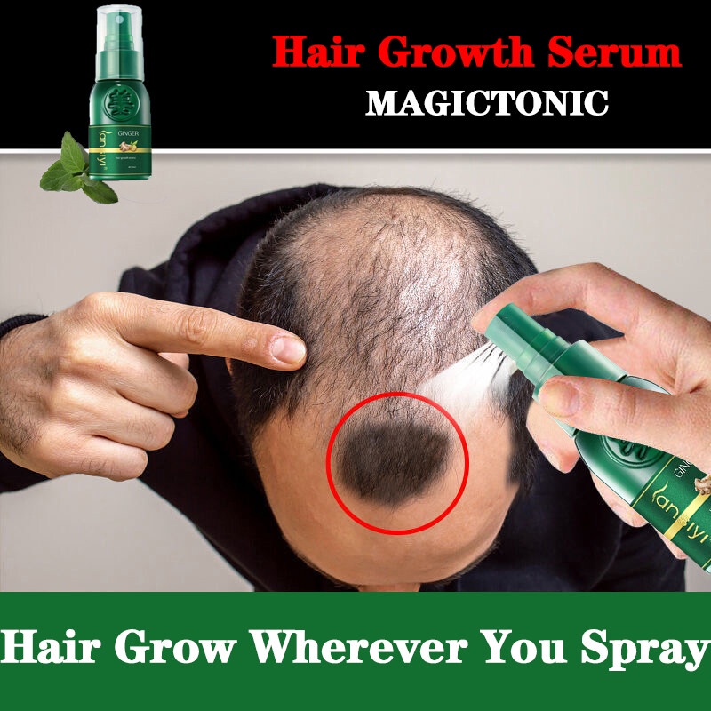 Serum Mọc Tóc Nhanh Gừng Tự Nhiên, Phục Hồi Dày Chống Rụng Tóc, Tinh Chất Chiết Xuất Chất Lỏng Điều Trị Phát Triển Tóc Mọc Da Đầu 30Ml