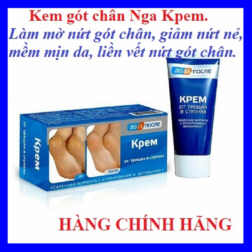 Kem nứt gót chân Kpem Nga, Kem làm liền vết nứt chân tay - Hàng nội địa Nga