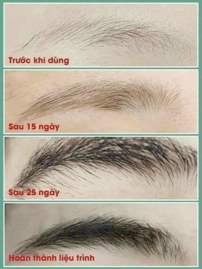 Dưỡng lông mày, serum dưỡng mày, kích mọc chân mày đen, rậm, theo khung đẹp