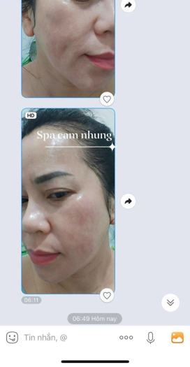 Kem sâm nhung Tươi, Tặng 1 Chai Serum + 1 Tế Bào Chết