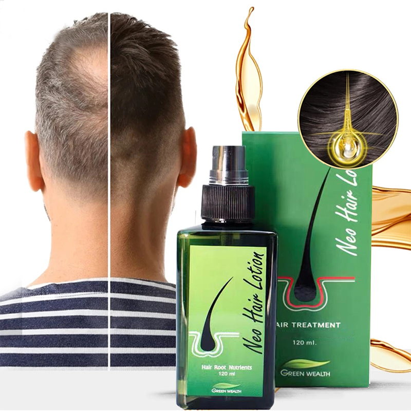 Buy Neo Hair Lotion - Hair Treatment, Hair Root Nutrients, Hair Growth, and  Anti Hair Loss at Best Prices Online on Thaitrade.com
