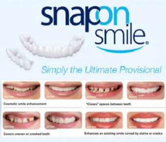 Răng giả Snap on smile  cung cấp nhiều giải pháp để thay thế răng bị mất hoặc bị suy yếu