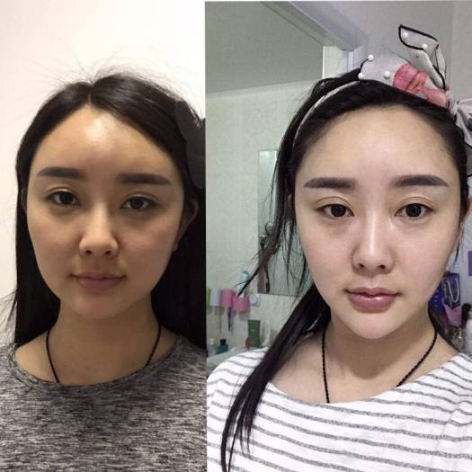 Kem xoa Thon Gọn Tạo Mặt V-Line Giảm Nọng Cằm