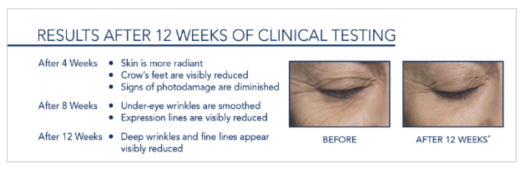 Kem dưỡng ban ngày xóa nếp nhăn RoC Retinol Correxion Deep Wrinkle Daily Moisturizer SPF 30 (33ml