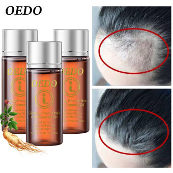 OEDO 3PCS Tinh chất mọc tóc ngăn rụng tóc bóng dầu không mùi chiết xuất nhân sâm Hàn Quốc