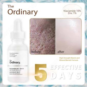 The Ordinary Niacinamide 10% ZinC 1% ngừa mụn trắng da Serum dưỡng da phục hồi da chính hãng Serum the ordianry niaciamine