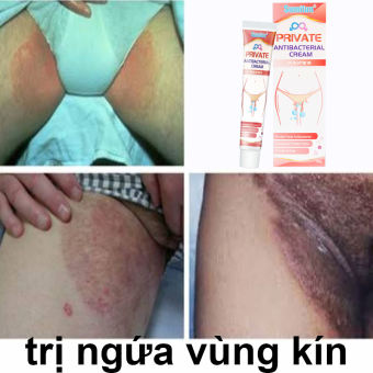 Kem bôi nấm ngứa, bôi viêm da ngứa da chàm da, á sừng, kem bôi nấm thảo dược, giảm ngứa giảm đau da 20g