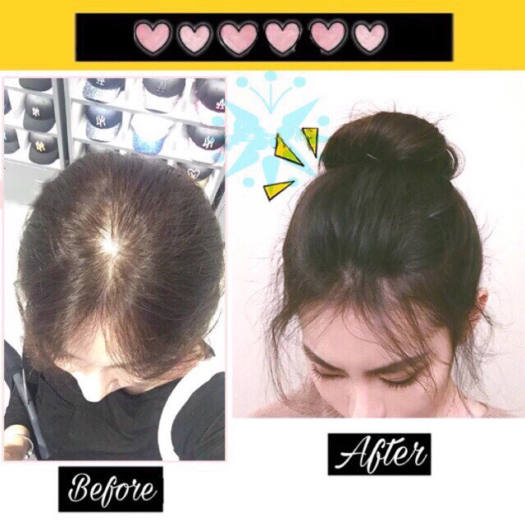 TÓC MÁI PHỒNG - kẹp làm phồng tóc mái - Tóc độn phồng đỉnh đầu