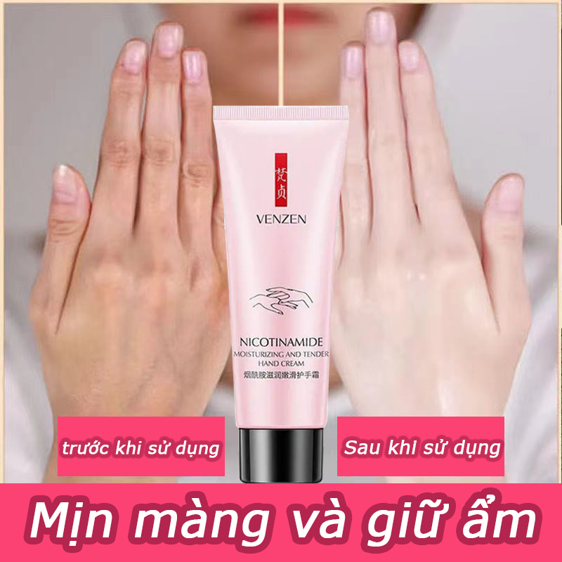 Kem dưỡng da tay chống nhăn da, chống lão hóa da, da nẻ mấy cũng hết nẻ
