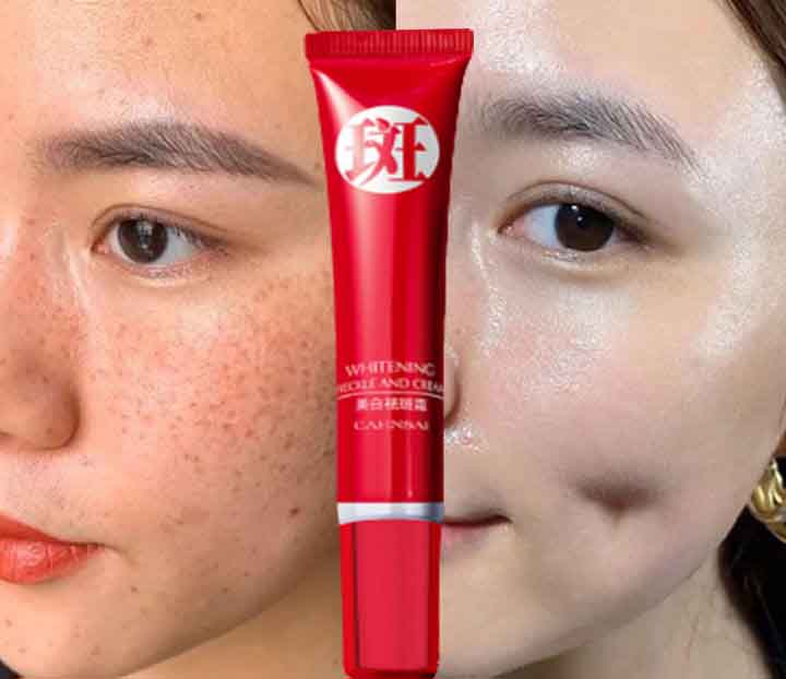 (7 ngày loại bỏ tàn nhang) Kem làm trắng da chống tàn nhang chuyên sâu ban đầu Loại bỏ tuổi tác mạnh mẽ Loại bỏ đốm đen Sắc tố làm sáng da Chăm sóc da mặt trời Loại bỏ tàn nhang cho phụ nữ Làm sáng da mặt Kem dưỡng trắng da ban đêm Loại bỏ Melanin cho nam