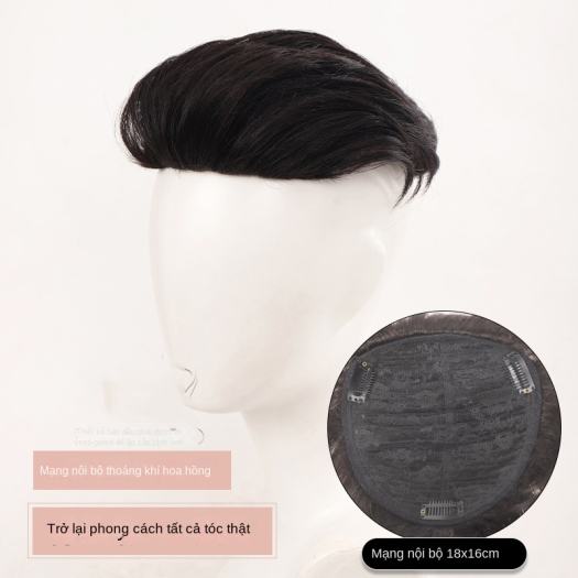 Tóc bạc sớm ở người trẻ hệ lụy từ thói quen thường ngày ít ai ngờ