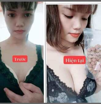 Kẹo mầm nở ngực to, săn chắc, đẫy đà, đẹp da.... thảo mộc 37 (mua 4 hộp tặng 1 hộp = 5 hộp + dây đo )
