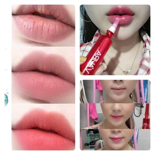 Cấy môi VAURA 2 làm hồng môi, trị thâm môi BABIER LIPS VOLUME
