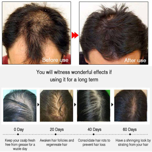 Qik Hair - Hỗ trợ giảm rụng, kích thích mọc tóc chắc khỏe cho cả nam và nữ