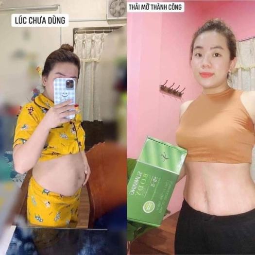 Bộ Đai Ủ Nóng Tan Mỡ Slimming Body SB-II Hàng Chính Hãng, Quấn Nóng Giúp Thải Mỡ Bụng Mỡ Thừa Định Hình Eo Nhanh Về Dáng Cho Chị Em Và An Toàn Cho Mẹ Sau Sinh