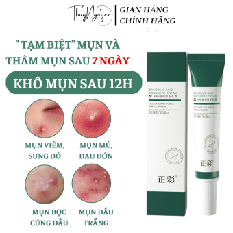 Kem chấm mụn HẾT MỤN 100%, SẠCH MỤN TẬN GỐC, AXIT SALICYLIC hiệu quả hết mụn siêu tốc ngừa sẹo thâm 20g