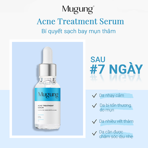 Serum giảm mụn Mugung 7 ngày hiệu quả giảm mụn đầu đen mụn bọc (Làm xẹp không bong da) Acne Treatment 15ml và Nước Tẩy Trang Mugung 100ml
