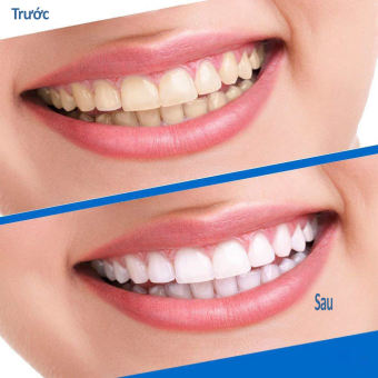 Set 7 Miếng dán trắng răng 5D White Teeth Whitening Strips, miếng dán trắng răng 3d miếng dán trắng răng chính hãng, miếng dán trắng răng crest 3d white , miếng dán trắng răng oral b  - Milaganics Store