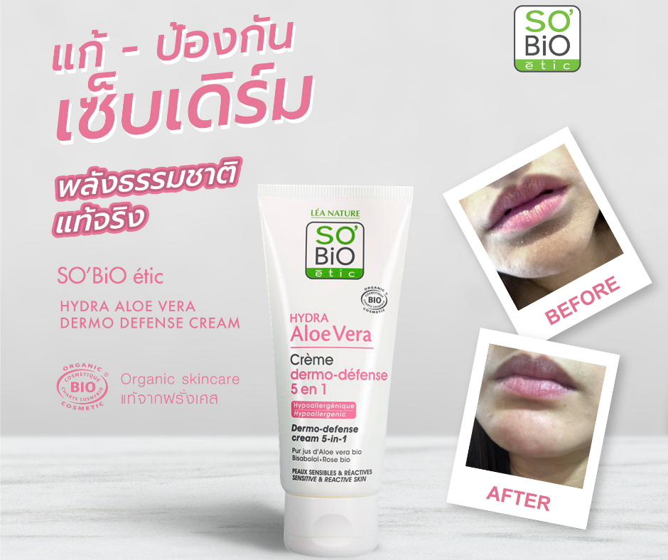 So'Bio Etic | Hydra Aloe Vera Dermo-Defense Cream 50ml. For Sensitive Skin, Adding Water to the Skin Makes It Moisturized, Smooth, and Soft, Eliminating the Problem of Inflamed Skin, Dry Skin, Redness, and Itchy Rashes, While Also Creating Strong Skin f ราคา 1,199 บาท*ส่งฟรี