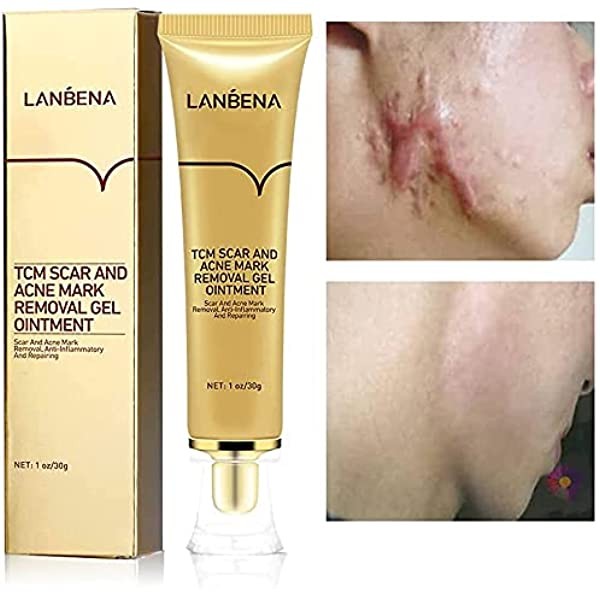 Lanbena kem mờ sẹo phục hồi sẹo làm mờ rạn phục hồi rạn làm sáng da giảm vết thâm sẹo thâm bỏng