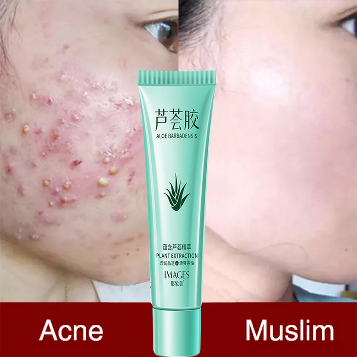 Gambar Aloe Vera vitanmin E Gel Moisturizing Anti Acne Potion Repair Mask 20g 100% Original Aloe Vera Soothing Gel Summer Girls Moisturizing Aloe Mask Aloe Vera Gel Anti Aging