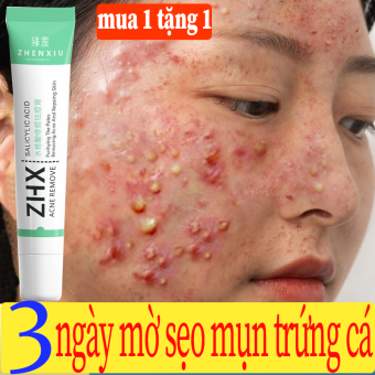 Gel chống mụn Loại bỏ mụn trứng cá, vết thâm, mụn trứng cá nhẹ nhàng 20ml Kem ngừa mụn trứng cá,giảm mụn trứng cá