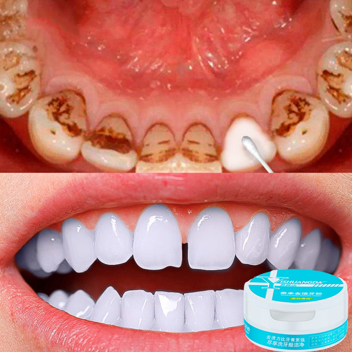 Bột trắng răng, làm trắng, làm sạch khoang miệng, ngăn ngừa vi khuẩn sâu răng, bột tẩy trắng răng 50g