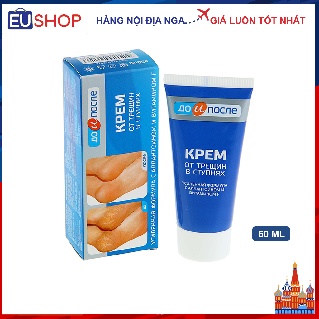 Kem dưỡng nứt gót chân KPEM Nga - Tuýp 50ml