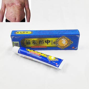 Kem đông y bôi vảy nến hiệu quả