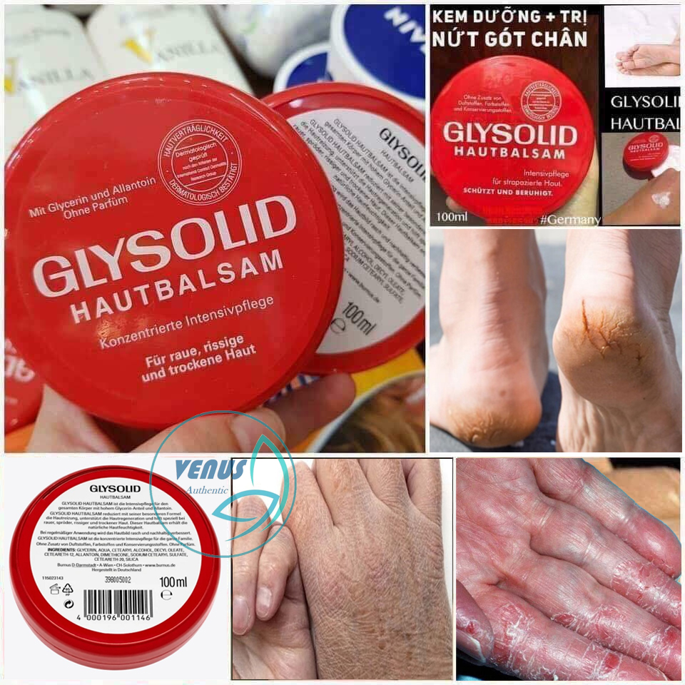 Kem dưỡng nẻ Glysolid Hautbalsam Đức trị da khô nứt nẻ bong tróc á sừng vảy nến 100ml - Nội địa Đức